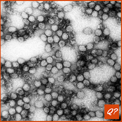 flavivirus